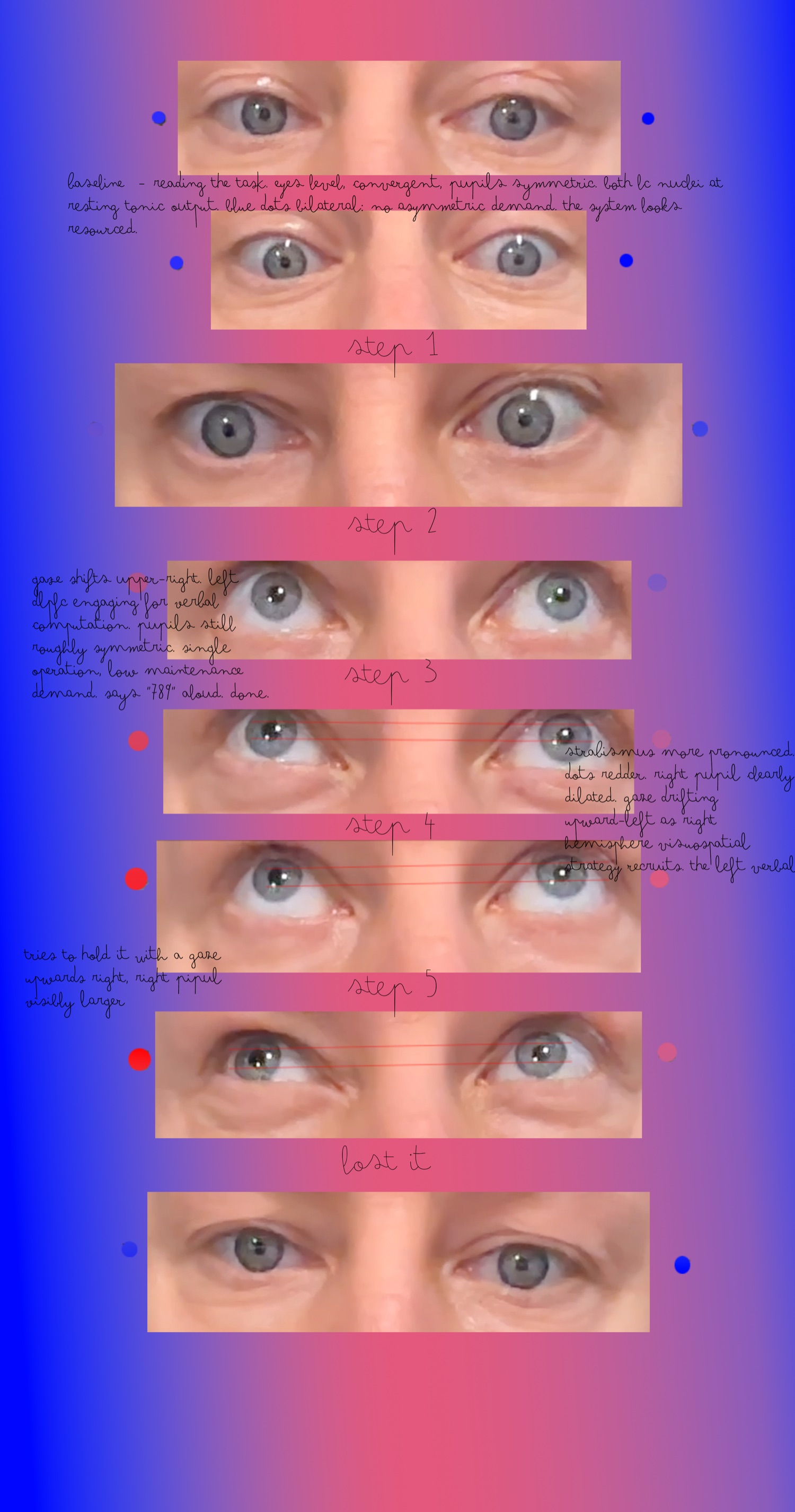 A tall vertical sequence of close-ups of my own eyes across a mental-arithmetic task, hand-annotated. Stages baseline through step 5 and 'lost it'. From step 3 onward the right pupil is visibly more dilated than the left, with thin red rules drawn between the two pupils to mark the gap.